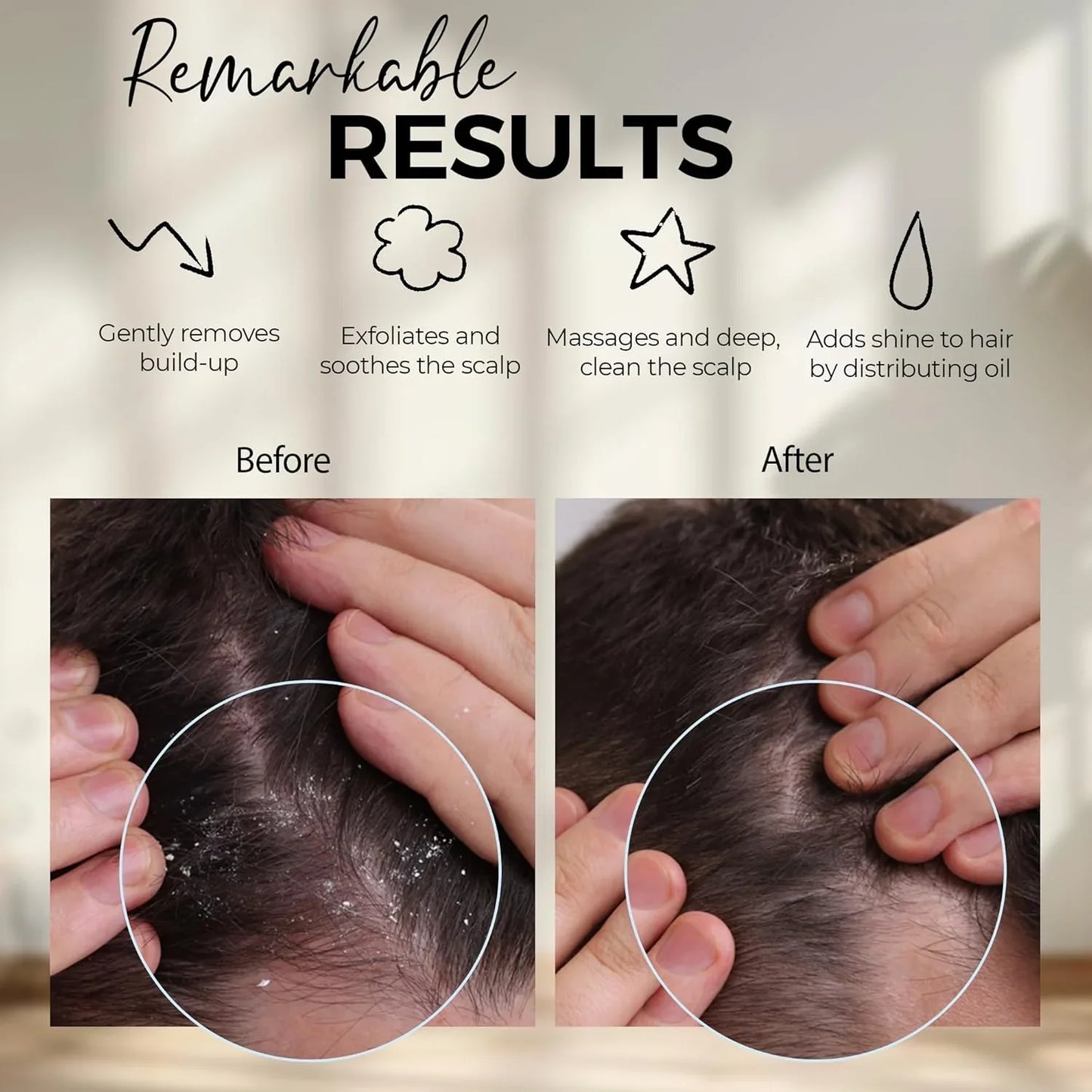 Before and after closeup of scalp showing removal of dandruff with scalp massager results