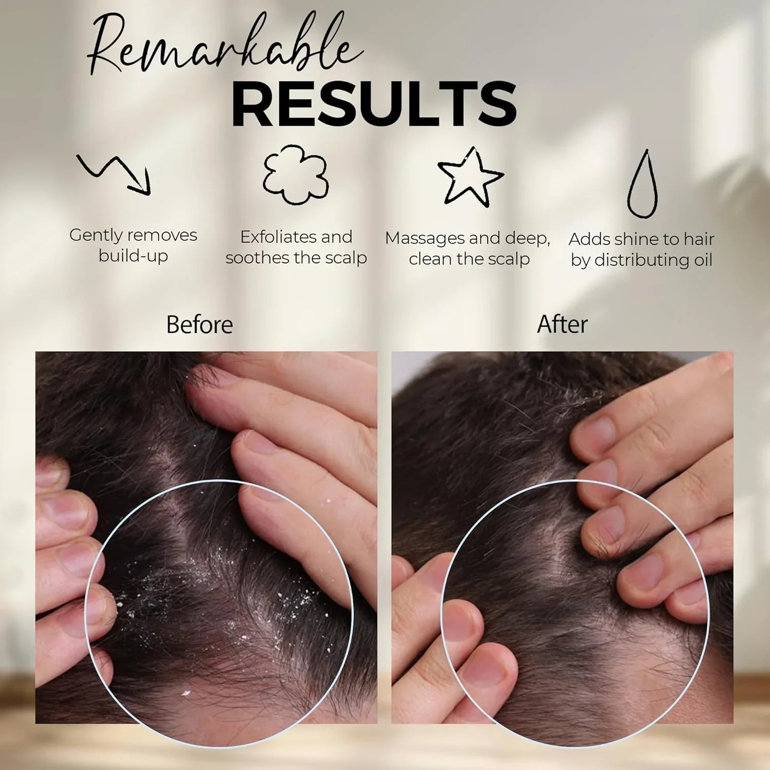 Before and after closeup of scalp showing removal of dandruff with scalp massager results